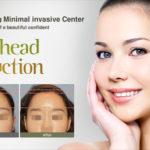 Forehead Reduction Surgeon In Bangalore
