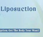 Liposuction Revision Surgeon In Bangalore