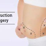 Liposuction Surgeon In Bangalore