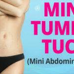 Mini Tummy Tuck Surgeon In Bangalore