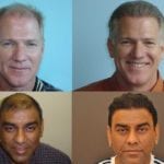 Hair Transplant and Cost