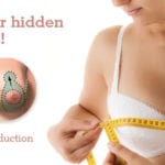 Breast Reduction Surgery in Bangalore