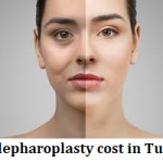 Blepharoplasty cost in turkey