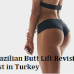 Brazilian Butt Lift Revision cost in Turkey