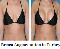 Breast Augmentation - HBS Turkey.com