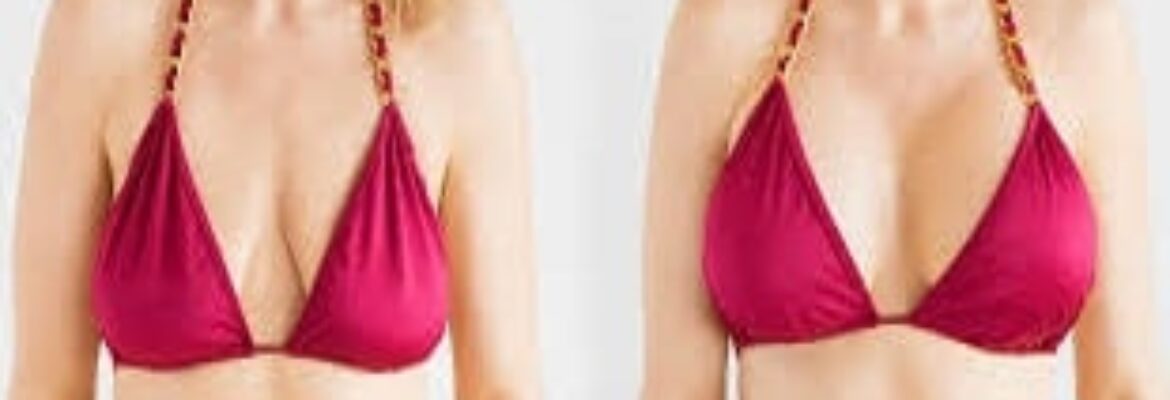Best Breast Implants Surgeons in Turkey – Find Cost Estimate, Reviews and Book Appointment