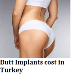 Butt Implants cost in Turkey