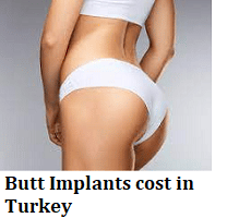 Butt Implants Turkey - Butt Implant Cost