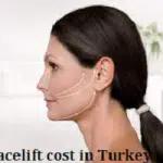Facelift cost in Turkey
