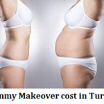 Mommy Makeover cost in Turkey