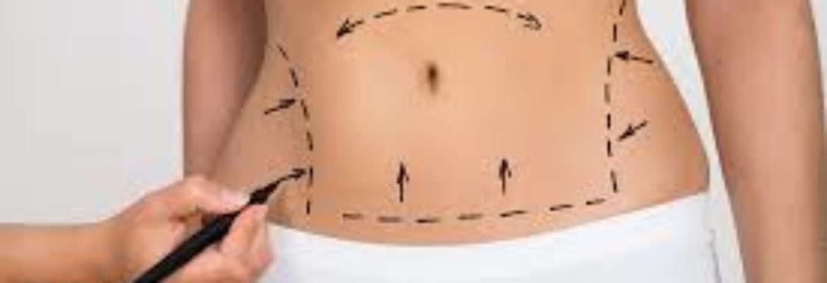 Best Tummy Tuck Surgeons in Turkey – Find Cost, Reviews, After Photos, Book Appointment
