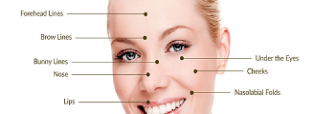 Dermal Fillers in Dhaka – Find Cost Estimate, Reviews, Best Dermatologists and Book Appointment
