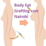 Body Fat Grafting cost in Nairobi