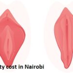 Vaginoplasty cost in Nairobi