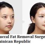 Best Buccal Fat Removal Surgeons in Dominican Republic