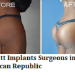 Best Butt Implants Surgeons in Dominican Republic