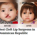 Best Cleft Lip Surgeons in Dominican Republic
