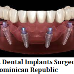 Best Dental Implants Surgeons in Dominican Republic