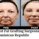 Best Fat Grafting Surgeons in Dominican Republic