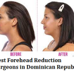 Best Forehead Reduction Surgeons in Dominican Republic