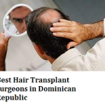 Best Hair Transplant Surgeons in Dominican Republic