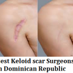 Best Keloid scar Surgeons in Dominican Republic