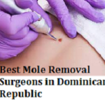 Best Mole Removal Surgeons in Dominican Republic