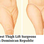 Best Thigh Lift Surgeons in Dominican Republic