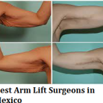 Best Arm Lift Surgeons in Mexico