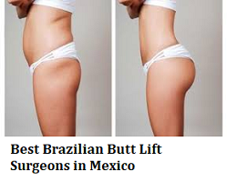 Lift brazilian surgery butt What Is