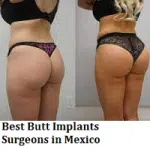 Best Butt Implants Surgeons in Mexico