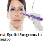 Best Eyelid Surgeons in Mexico
