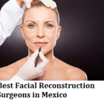 Best Facial Reconstruction Surgeons in Mexico