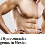 Best Gynecomastia Surgeons in Mexico