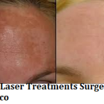 Best Laser Treatments Surgeons in Mexico