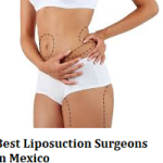 Best Liposuction Surgeons in Mexico