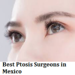 Best Ptosis Surgeons in Mexico