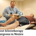 Best Sclerotherapy Surgeons in Mexico