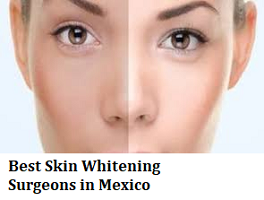 Best Skin Whitening Surgeons in Mexico Find Cost and Reviews