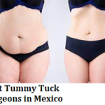 Best Tummy Tuck Surgeons in Mexico
