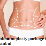 Abdominoplasty package in Istanbul