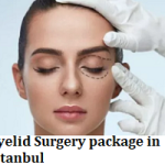 Eyelid Surgery package in Istanbul