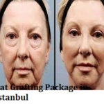 Fat Grafting Package in Istanbul