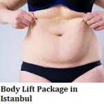 Body Lift Package in Istanbul