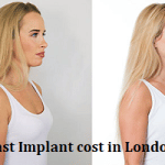 Breast Implant cost in London