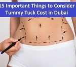 15 Important Things to Consider Tummy Tuck Cost in Dubai