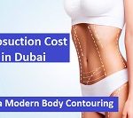 Liposuction Cost in Dubai – Ultra Modern Body Contouring