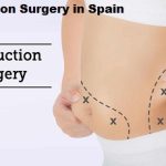 Liposuction Surgery in Spain