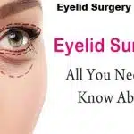 Eyelid Surgery in Spain