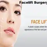 Facelift Surgery in Spain